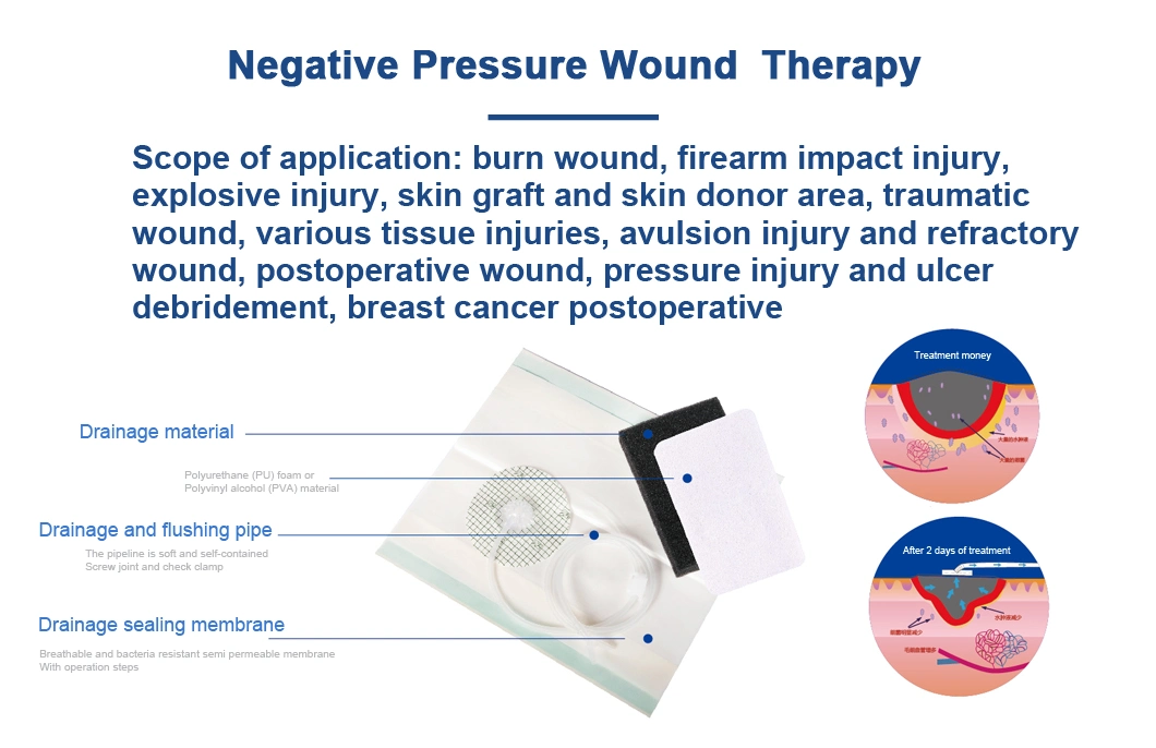White/Black Negative Pressure Wound Therapy Systems Wound Dressing Therapy for Burns, Trauma, Postoperative